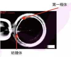 阴道炎对女性有哪些危害？