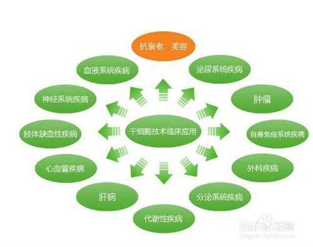对付脑卒中 医学界正探索干细胞疗法